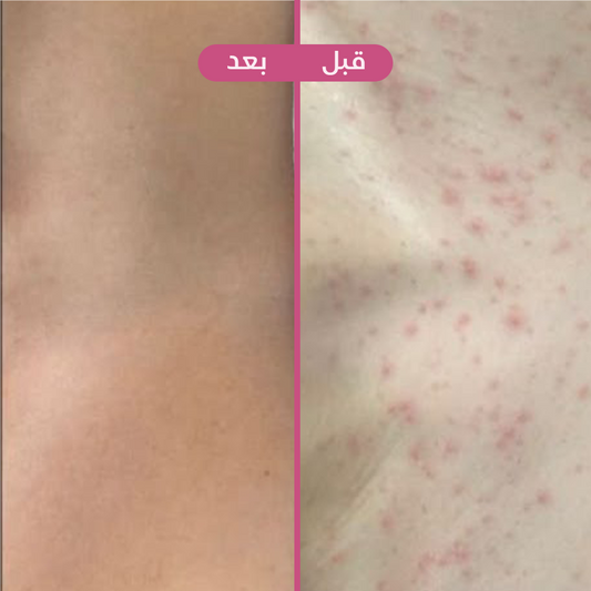 روز 🌸🛁