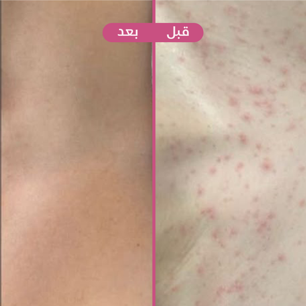 روز 🌸🛁