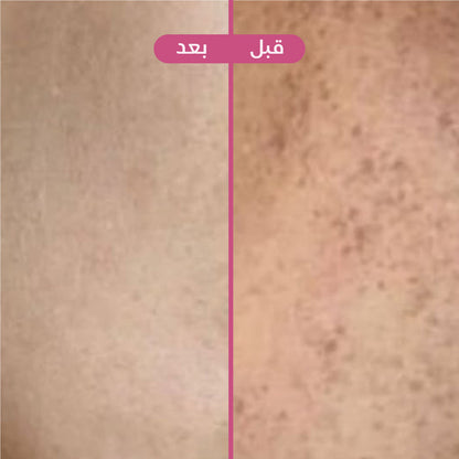 سنو وايت 🌸🛁