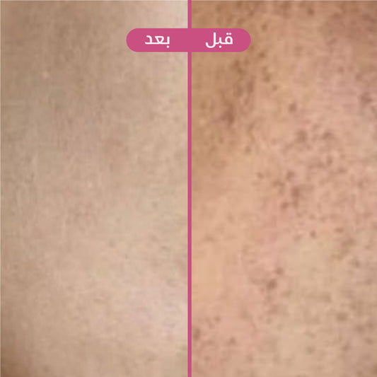 سنو وايت 🌸🛁